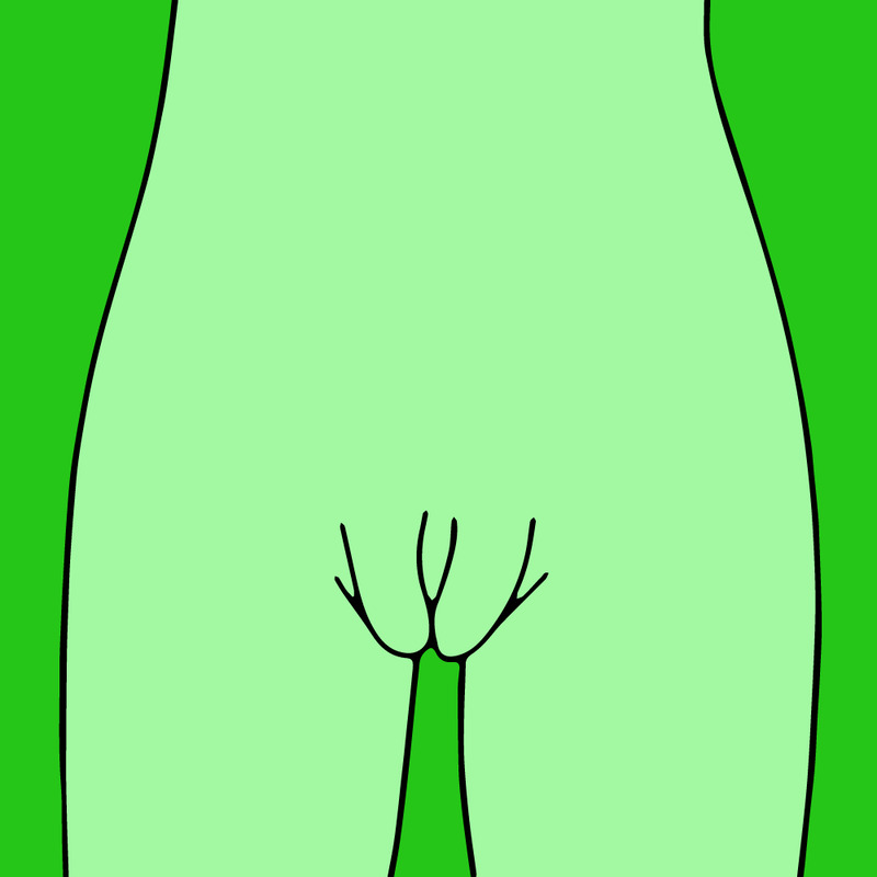 Horseshoe Vagina Type